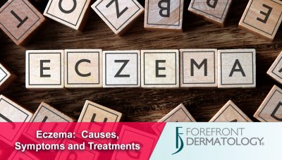 About Eczema: Causes and Symptoms