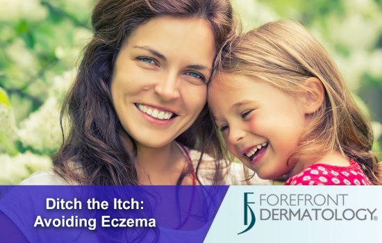 Ditch the Itch: Treating Eczema