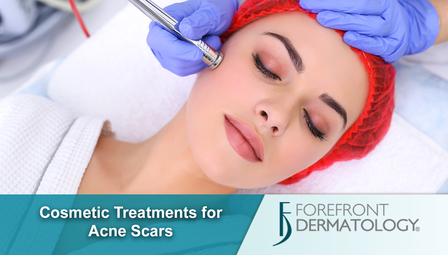 Cosmetic Treatments for Acne Scarring - DermSpecialists