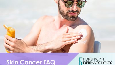 Skin Cancer FAQs