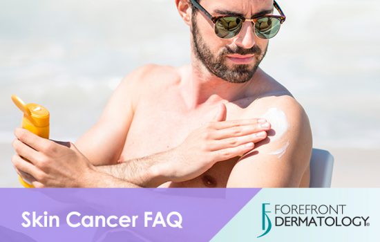 Skin Cancer FAQs