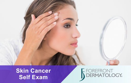 How to Perform a Monthly Skin Cancer Self-Examination
