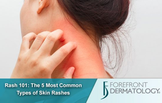Rash 101: The 5 Most Common Types of Skin Rashes