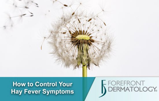 6 Tips to Help Control Your Hay Fever Symptoms