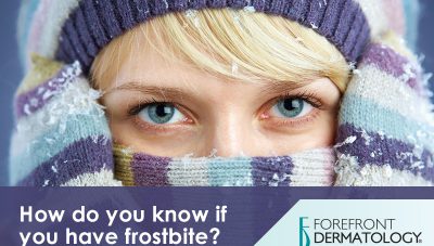 How to Tell if You Have Frostbite (And What to Do About It)