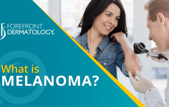 Get the Facts: Melanoma Skin Cancer