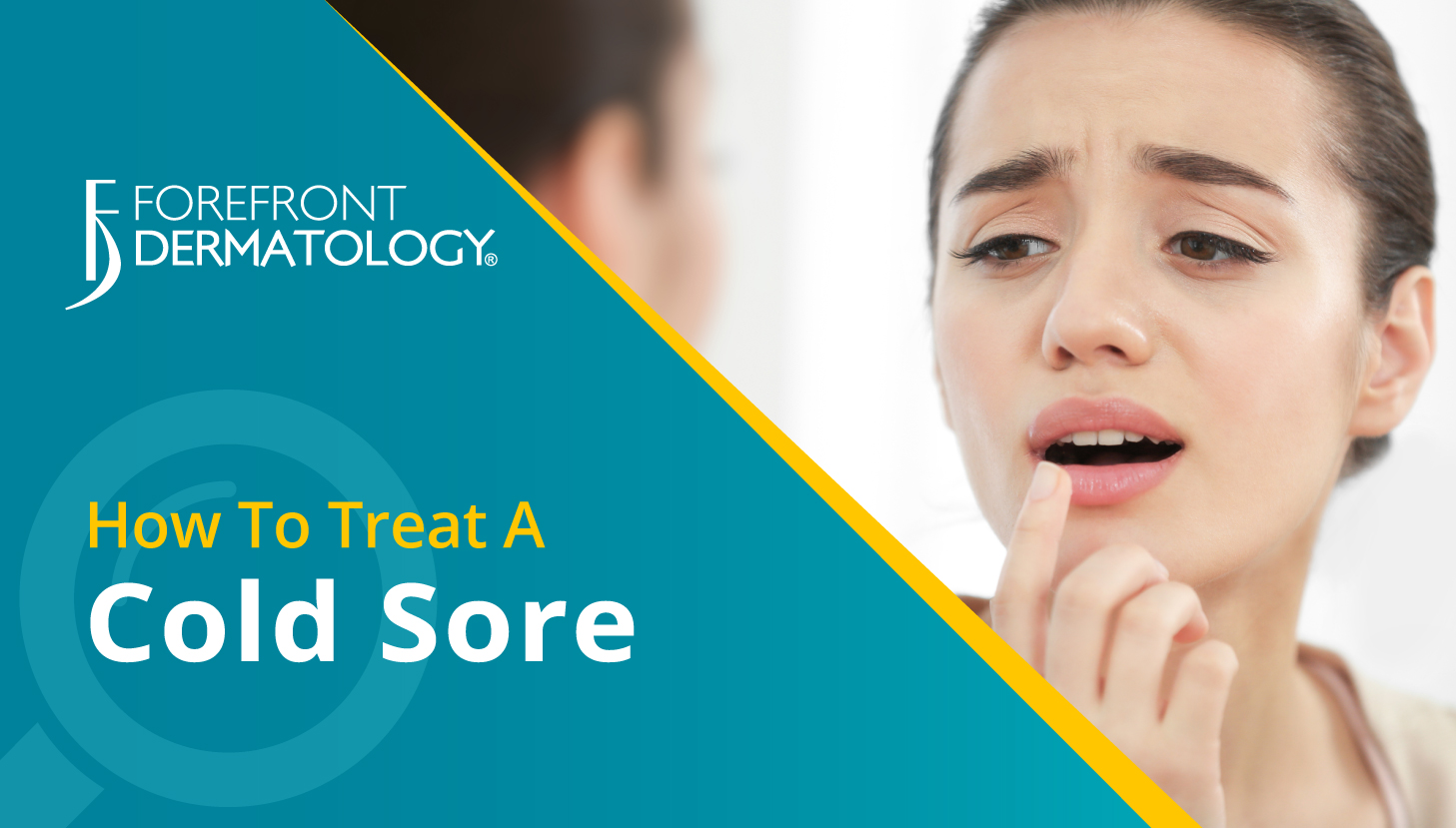 how-to-treat-a-cold-sore-dermspecialists